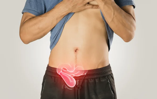 Hernia Surgery