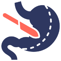 Bariatric Surgery
